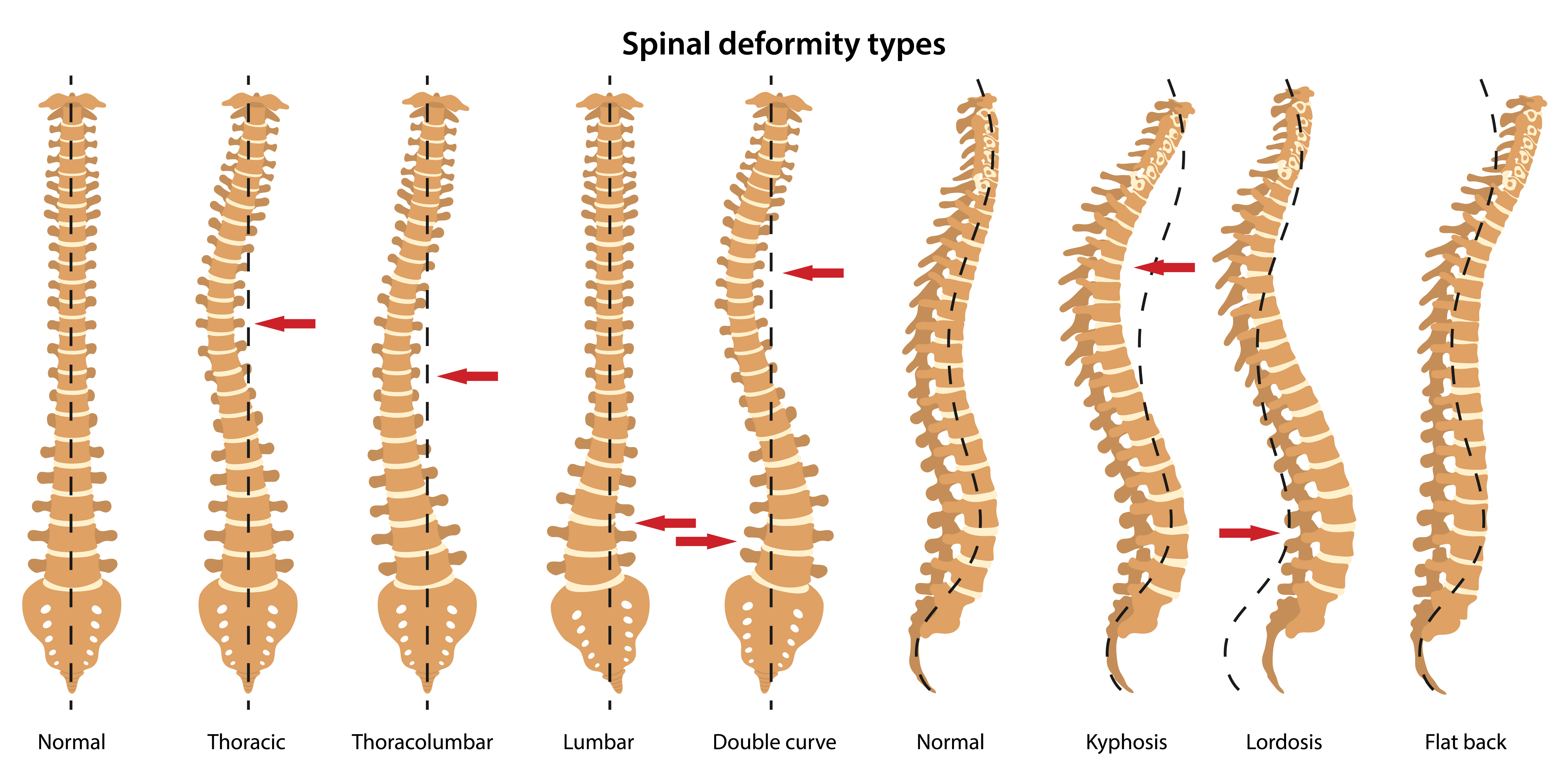 Posture & Curvature of the Spine