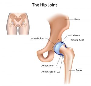 hip bursitis treatment