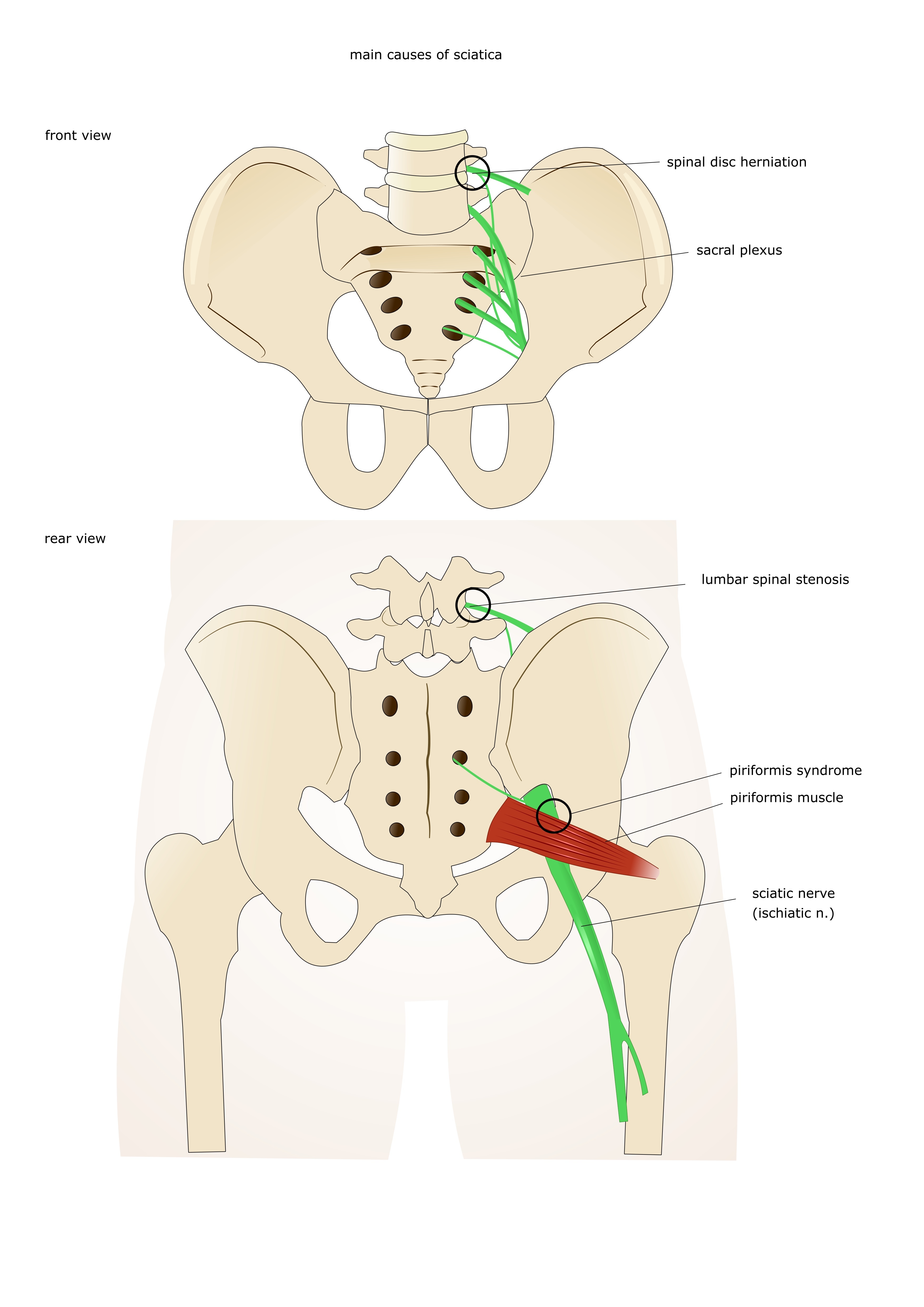Common Muscle Problems in the Thigh & Hip