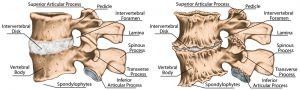 facet joint back pain