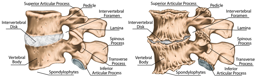 discul intervertebral cervical durere de șold la mișcare
