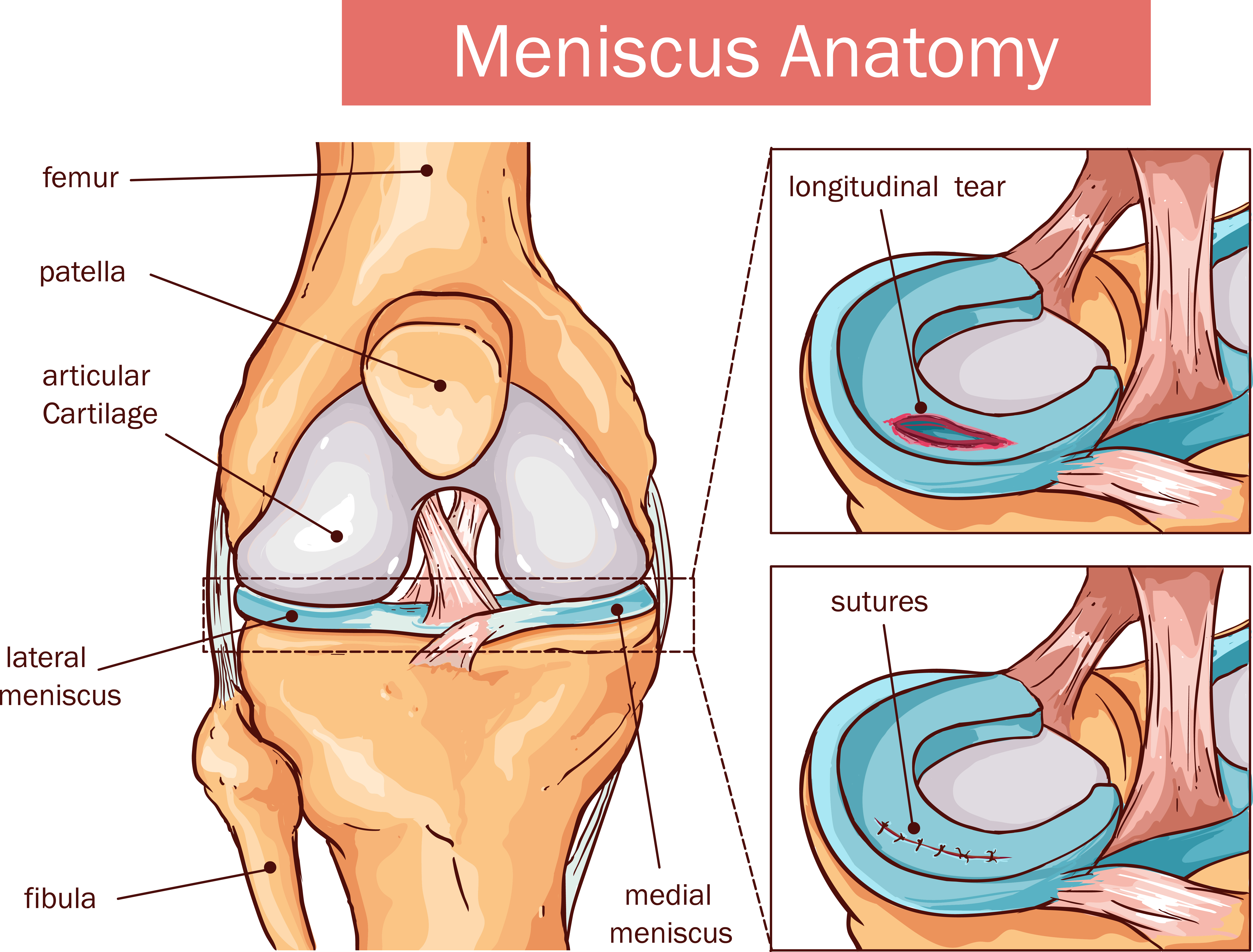 Повреждения мениска коленного сустава как лечить. Мениски коленного сустава анатомия. Мениски коленного сустава анатомия разрыв.