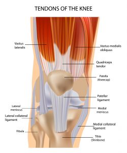 kneecap pain