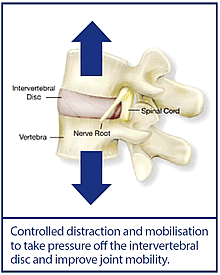 IDD Therapy Disc Treatment Joint Mobility