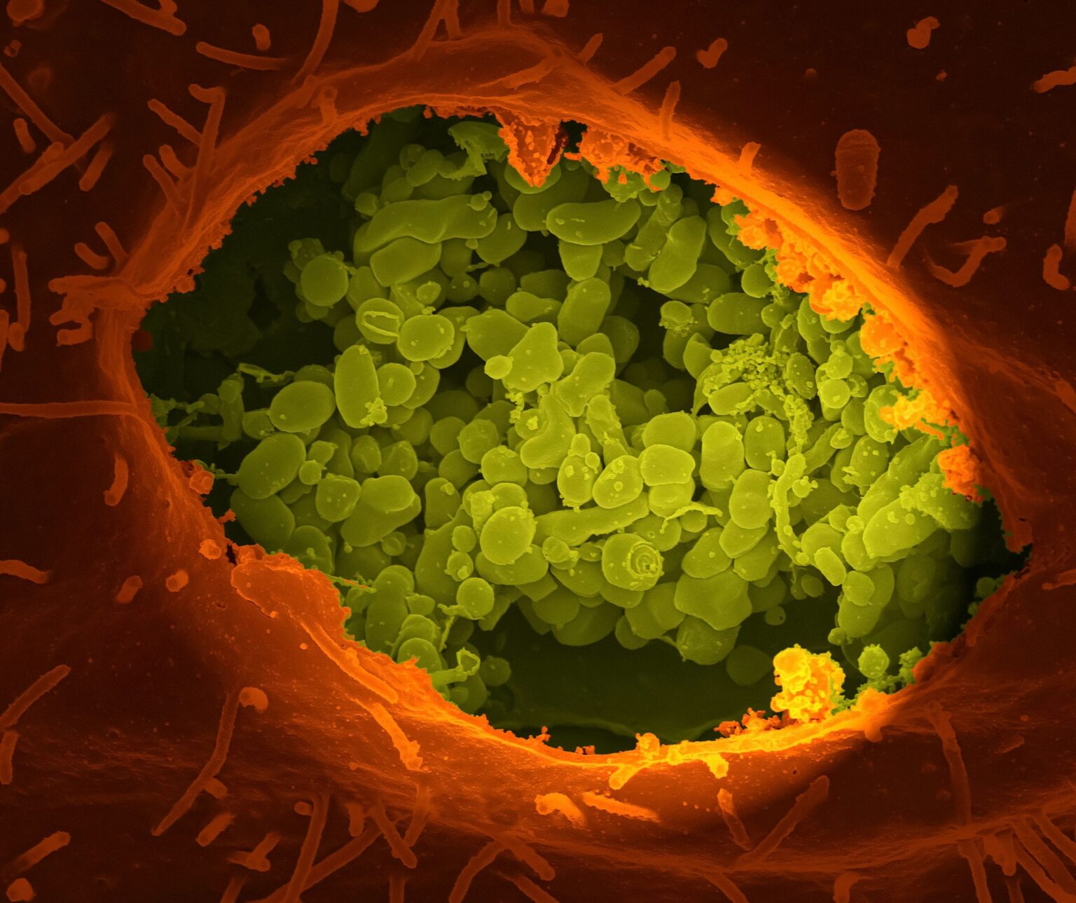 April is Colon Cancer Awareness Month: the Bacteria that live in our ...