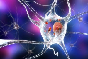 Degeneration of neurons in Parkinson's 