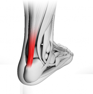 Achilles tendinopathy treatment Peak District| Achilles tendon